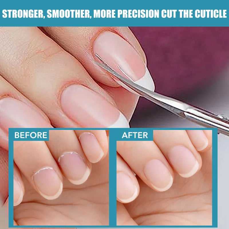 Premium Cuticle Scissors - Dead Skin Remover